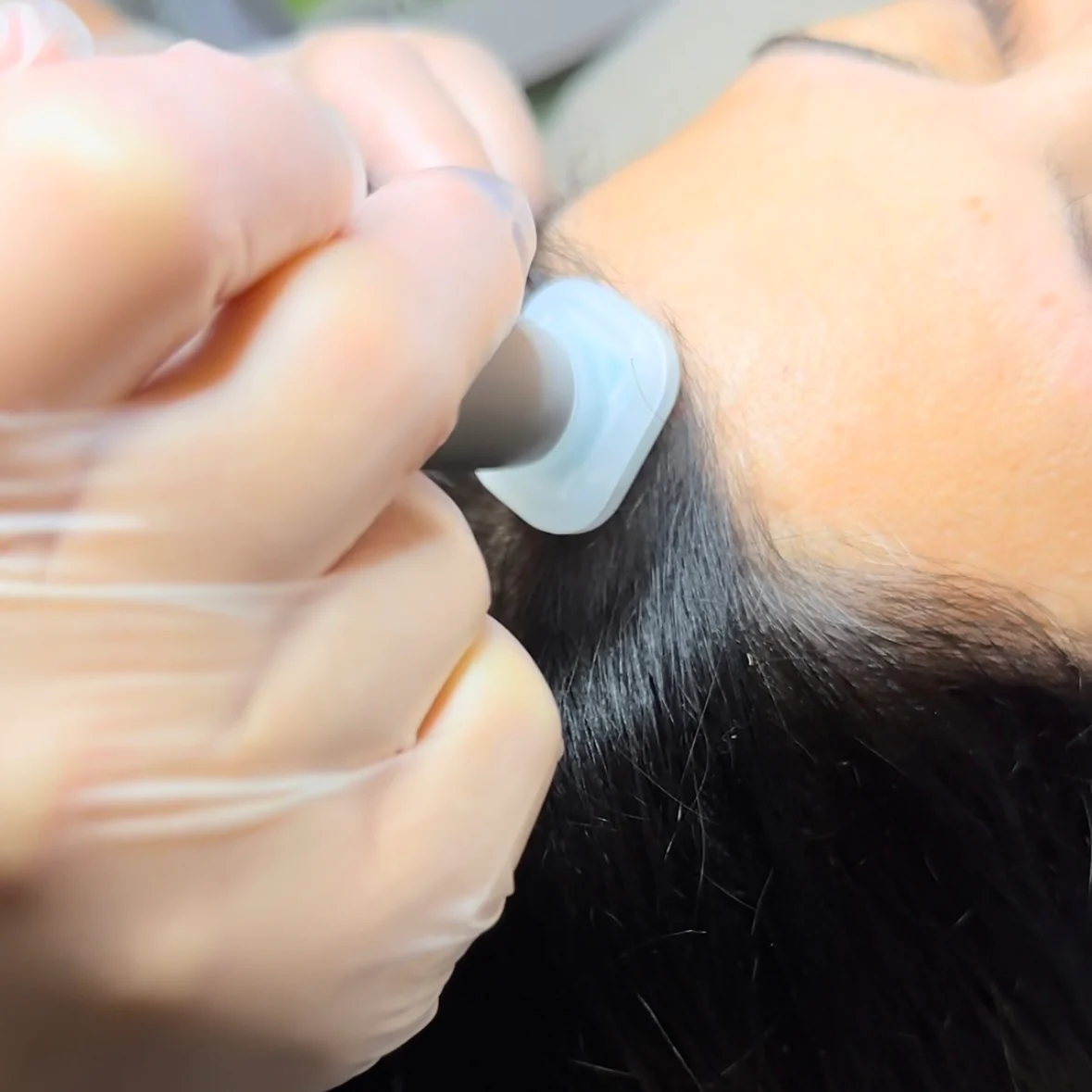 jetplasmahairregrowth