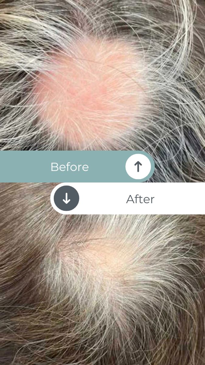 hairbeforeandafter1 Top Rated Massage + Wellness Center in San Luis Obispo