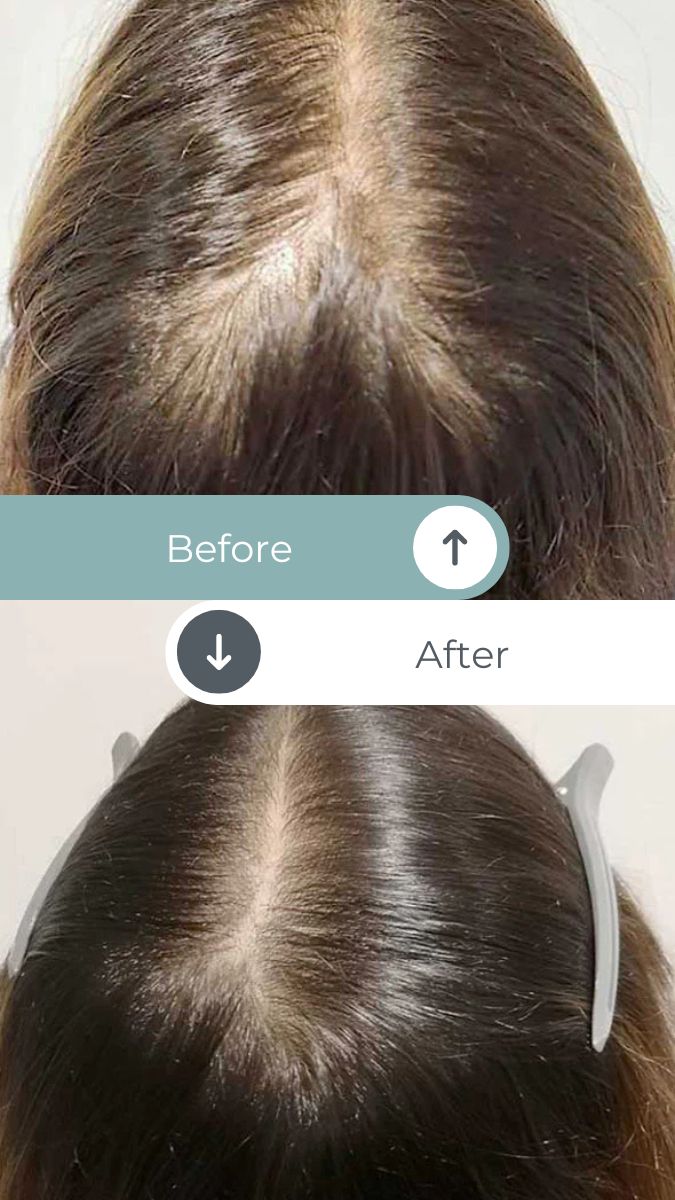 hairbeforeandafter3 Top Rated Massage + Wellness Center in San Luis Obispo