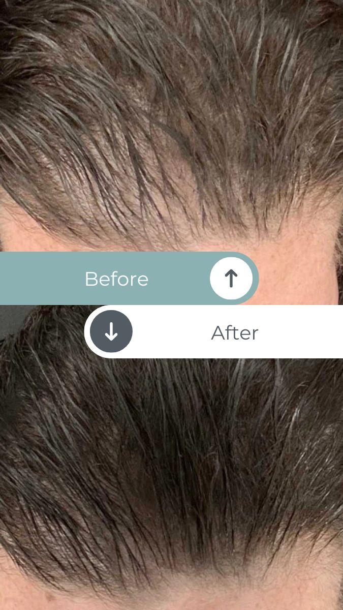 hairbeforeandafter4 Top Rated Massage + Wellness Center in San Luis Obispo