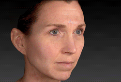 3dfacialanalysis